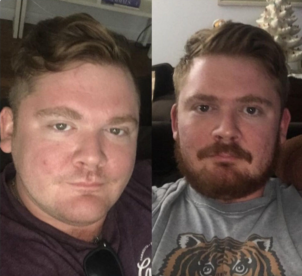 Chris Lexow has lost around 50 pounds since September 2018. 