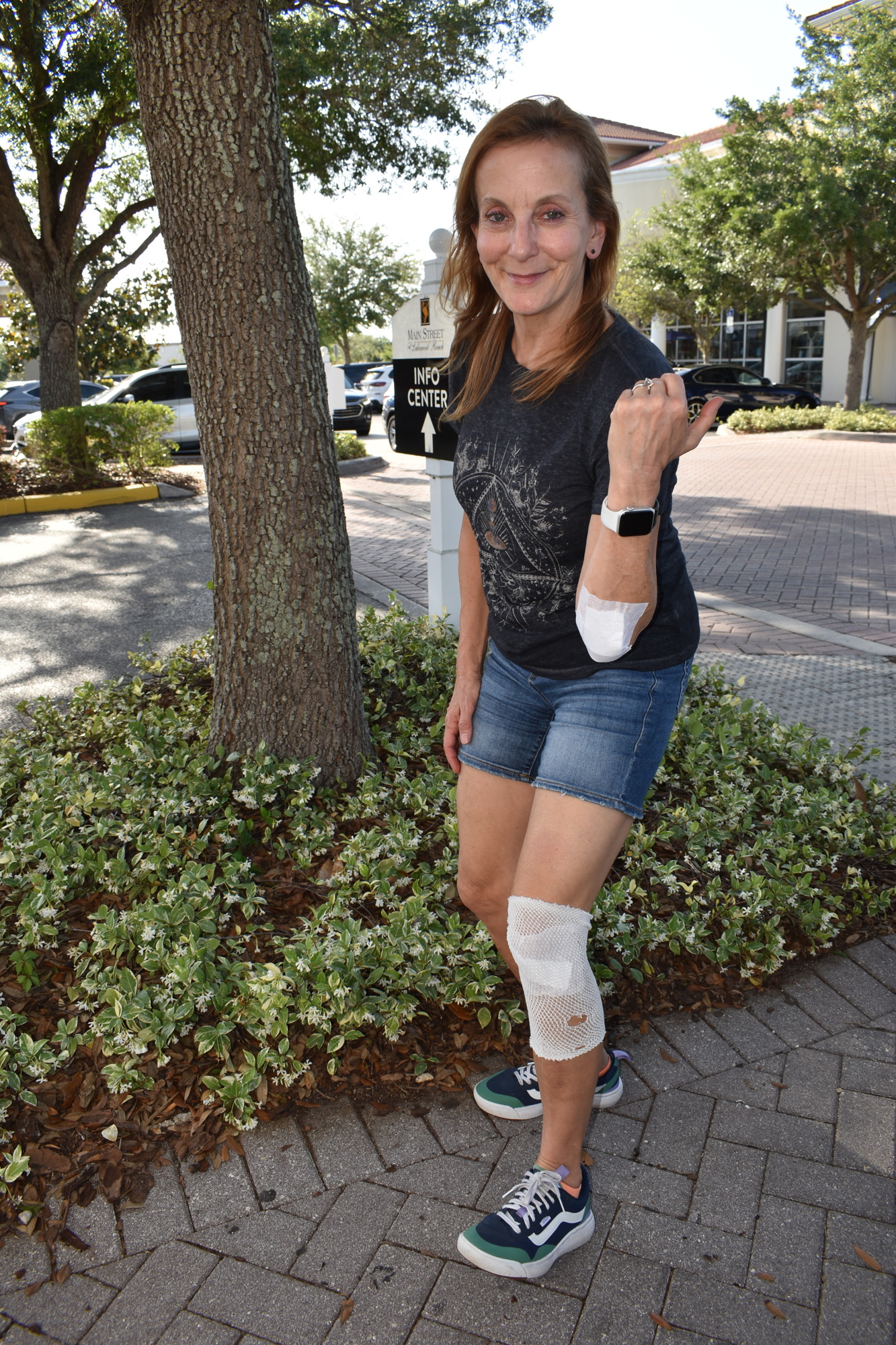 Two weeks after her incident on The Masters Avenue, Andrea Sacchetti still had her injuries bandaged.