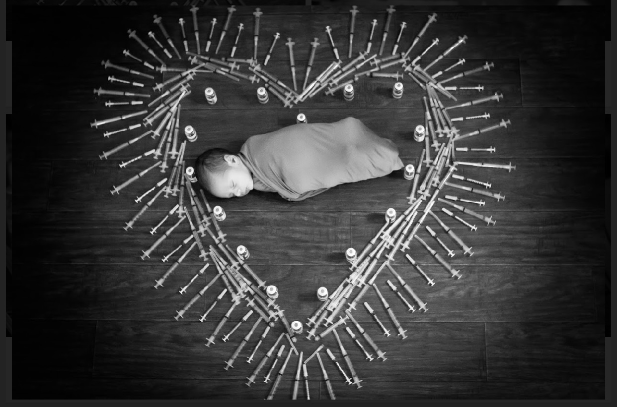 Lukas Ortiz was the subject of a newborn photo shoot. The needles represent the many self-administered injections his mother endured to get pregnant.